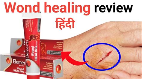 wound healing cream | wound healing cream review in Hindi | mi life ...