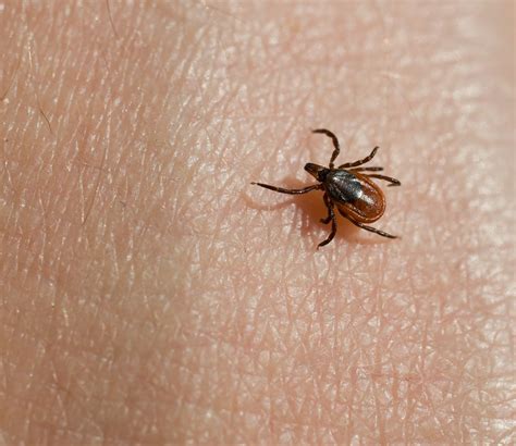 Ticks & Lyme Disease – Western UP Health Department