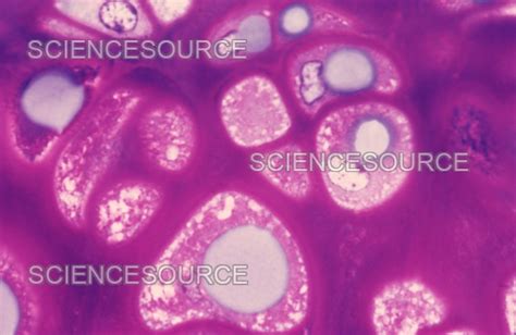 Photograph | Hyaline Cartilage and Chondroblasts | Science Source Images