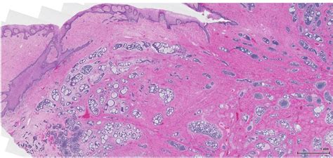 Bartholin Gland Histology