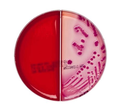 Thermo Scientific™ Columbia CNA Aesculin Selective Agar / MacConkey Agar No. 3 Modified | Fisher ...