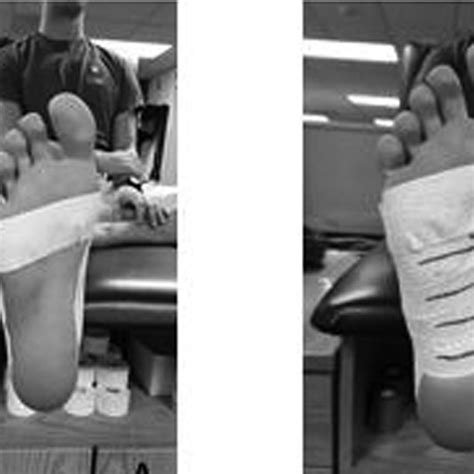 (PDF) Navicular Height Following Medial Longitudinal Arch Taping Techniques and a 20-Minute ...