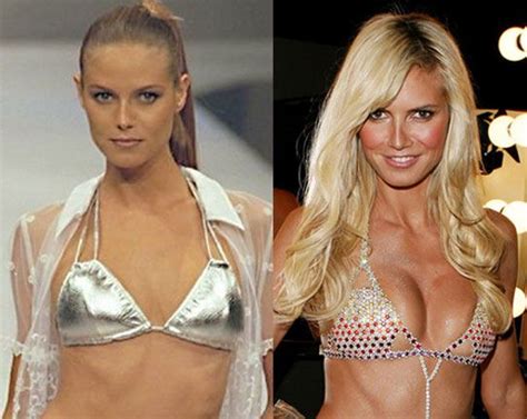 Heidi Klum - Breast Augmentation Heidi Klum, Plastic Surgery Photos, Celebrity Plastic Surgery ...