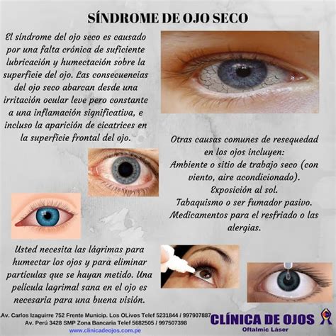 Clínica de Ojos Oftalmic Láser: SÍNDROME DE OJO SECO