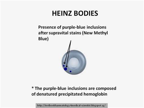 Haematology in a NutShell: Heinz Bodies