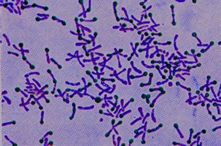 Listeria Gram