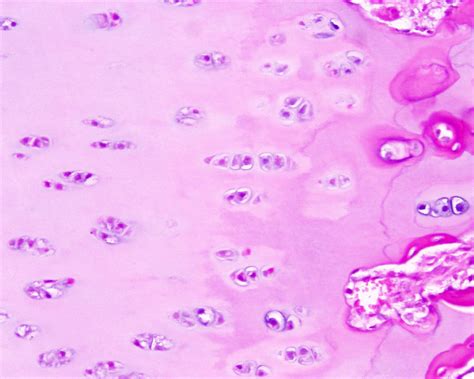 Cartilage Histology - Hyaline Cartilage - Histology Slide - 93C