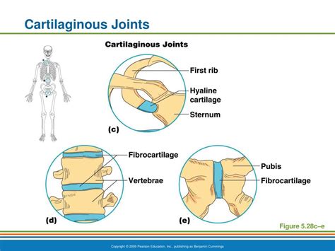 PPT - The Skeletal System PowerPoint Presentation, free download - ID ...