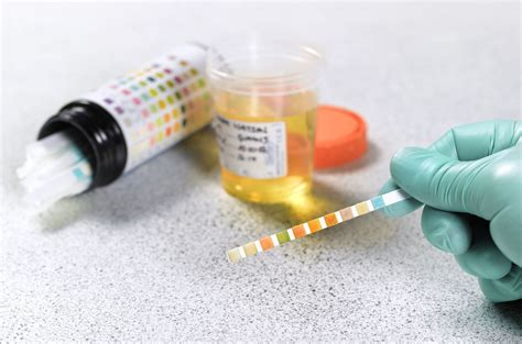 Urine Glucose Test: What It Measures, Results, Next Steps