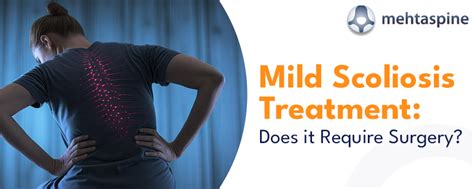 Mild Scoliosis Treatment: Does it Require Surgery? | Mr Jwalant S Mehta