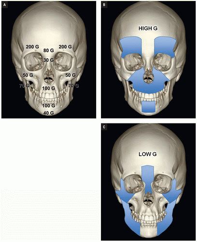 Maxillary Fracture Classification