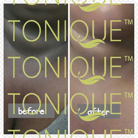 Natural Skin Lightening Before and After Pictures - Tonique Skincare