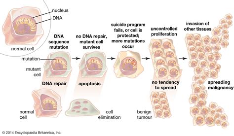 Benign tumour | pathology | Britannica