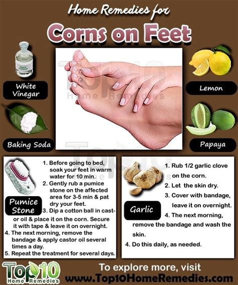 Home Remedies for Corns on Feet | Top 10 Home Remedies