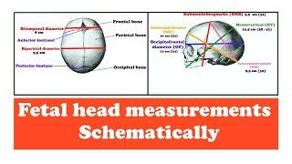 Best of fetal skull-diameters-mnemonic - Free Watch Download - Todaypk