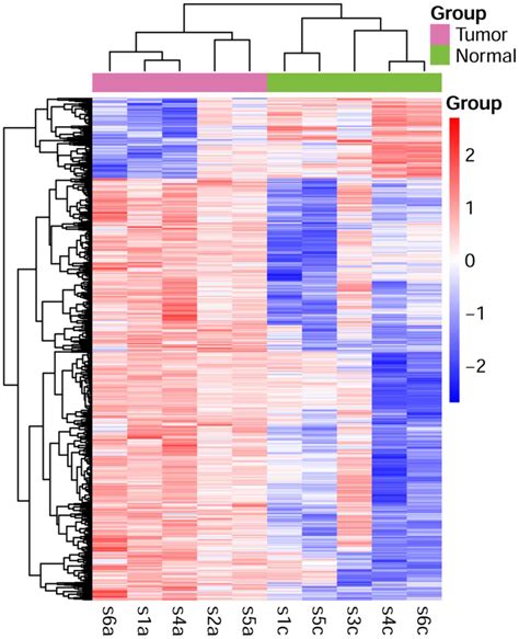 Transcriptome sequencing identifies key pathways and genes involved in gastric adenocarcinoma