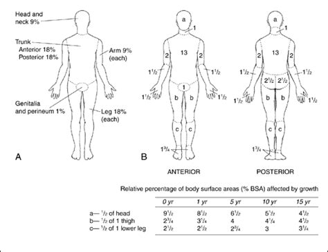 Burn Triage and Treatment - Thermal Injuries - CHEMM