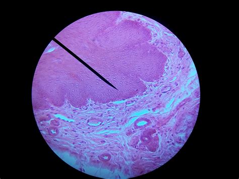 Capillary Epithelium