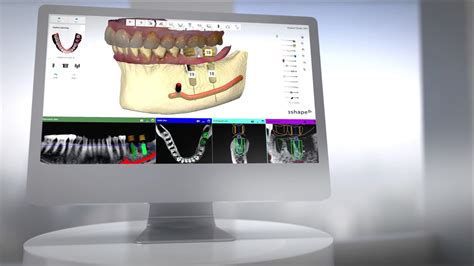 Presenting 3Shape solutions 2015 - YouTube