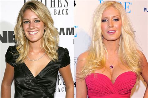 Celebrities' Plastic Surgery: See Before and After Photos