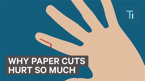 Why Paper Cuts Hurts So Much - YouTube