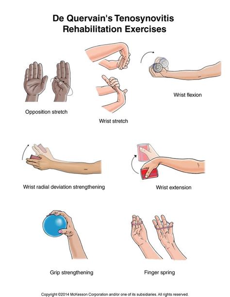 Summit Medical Group - De Quervain's Tenosynovitis Exercises | OT/hand ...