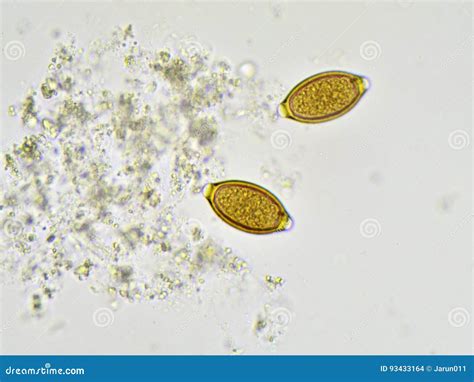 Trichuris Trichiura Royalty-Free Stock Photography | CartoonDealer.com #96910319