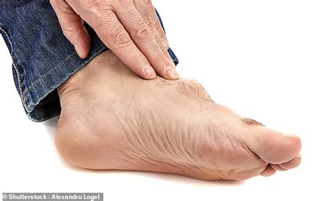 Is my numb big toe a sign of something sinister? DR MARTIN SCURR answers your health questions ...