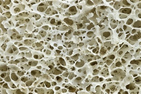 Fichier:Human hip bone texture.jpg — Wikipédia