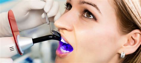 5 Different Types of Tooth Restoration - North York Dental Clinic