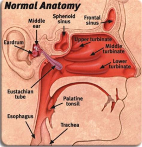 17 Best images about Ear Nose & Throat on Pinterest | Otitis media, Head and neck and Robotic ...