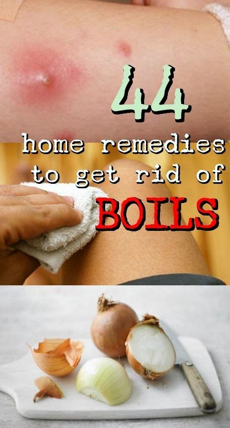 87 Best Armpit boils treatment at home for New Design | Ideas Home and Decor