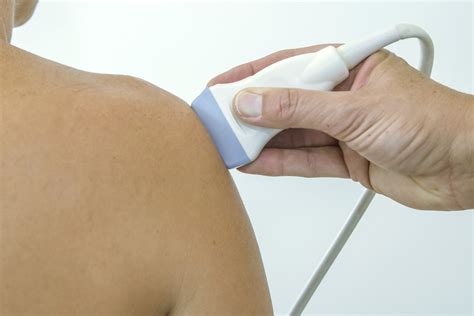 Ultrasound guided barbotage for calcific tendonitis shoulder