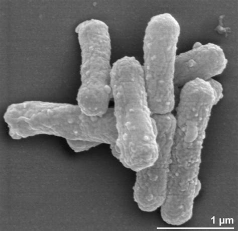 Hydrogenobacter thermophilus TK-6 | Type strain | DSM 6534, IAM 12695, JCM 7687, NBRC 102181 ...