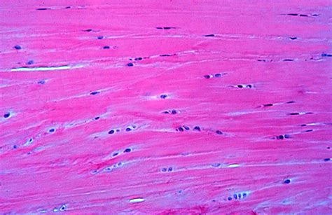 HLS [ Cartilage and Bone and Bone Histogenesis, fibrocartilage] HIGH MAG