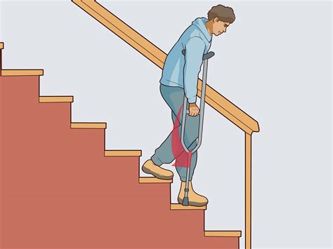 How to Use Crutches: 7 Steps (with Pictures) - wikiHow