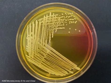 Mannitol Salt Agar: Principle, Uses, and Results • Microbe Online