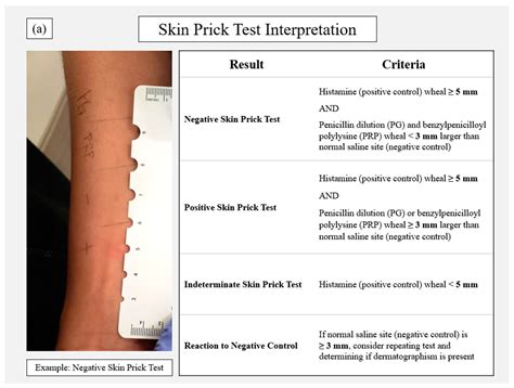 Pharmacy | Free Full-Text | Penicillin Allergy Skin Testing in the ...