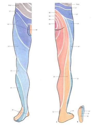 Sciatic nerve pain | Causes, symptoms and treatment