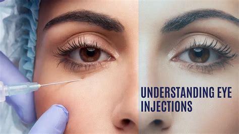 Understanding Eye Injections: A Comprehensive Guide