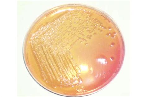 Macconkey Agar Lactose Fermentation