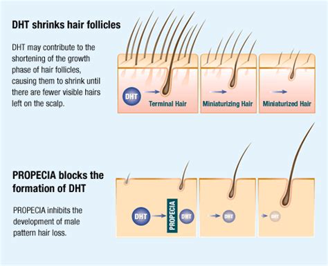 Hair Loss & Hijama | Hijama Cups