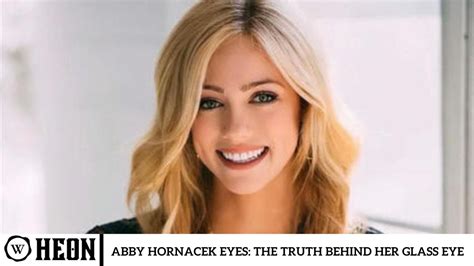 Abby Hornacek Eyes: The Truth Behind Her Glass Eye