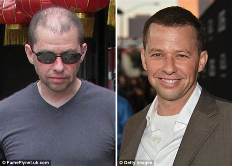 ‘Two and a Half Men’ Star Reveals Unusual Hair Loss Treatment