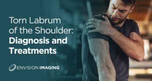 Torn Labrum of the Shoulder: Diagnosis and Treatments - Envision Radiology