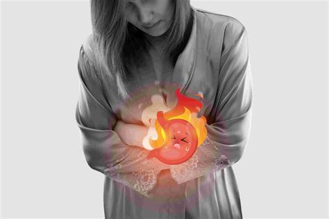 Gastroesophageal Reflux Disease (GERD): “Pills for life or Surgery ...