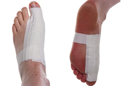 Turf Toe Taping | Physical Sports First Aid Blog