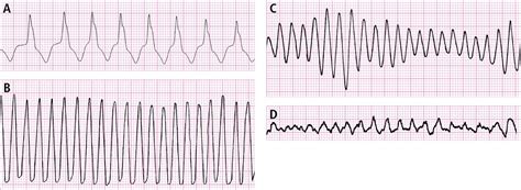 Pin on Nursing Studies - cardiac