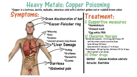 Copper Poisoning - YouTube