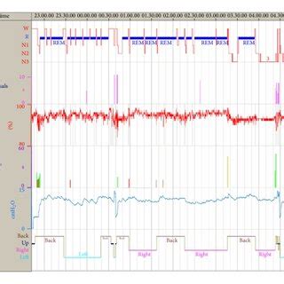 Analysis of the nocturnal polysomnography during automatic CPAP... | Download Scientific Diagram